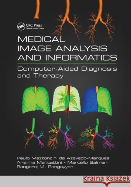 Medical Image Analysis and Informatics: Computer-Aided Diagnosis and Therapy Paulo Mazzoncini d Arianna Mencattini Marcello Salmeri 9780367876289