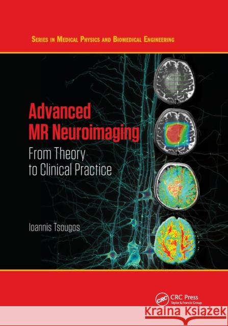 Advanced MR Neuroimaging: From Theory to Clinical Practice Ioannis Tsougos 9780367876500 CRC Press