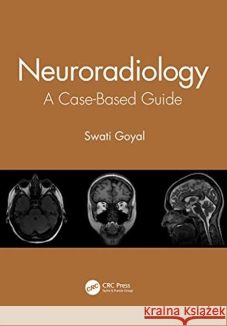 Neuroradiology: A Case-Based Guide Goyal, Swati 9780367903190 CRC Press