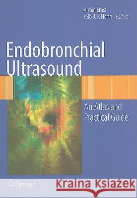 Endobronchial Ultrasound: An Atlas and Practical Guide Ernst, Armin 9780387094366 SPRINGER-VERLAG NEW YORK INC.