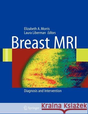 Breast MRI: Diagnosis and Intervention Liberman, Laura 9780387219974 Springer