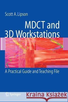 MDCT and 3D Workstations : A Practical How-To Guide and Teaching File Scott A. Lipson 9780387256795 