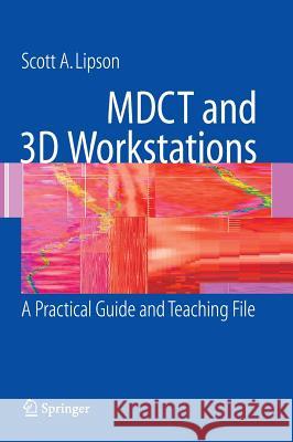 Mdct and 3D Workstations: A Practical How-To Guide and Teaching File Lipson, Scott A. 9780387256795 Springer