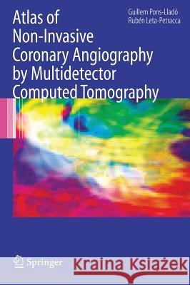 Atlas of Non-Invasive Coronary Angiography by Multidetector Computed Tomography Guillem Pons-Llado Ruben Leta-Petracca 9780387330440 Springer