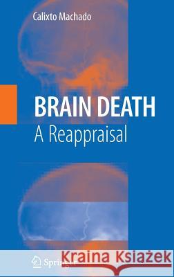 Brain Death: A Reappraisal Machado, C. 9780387389752 Springer