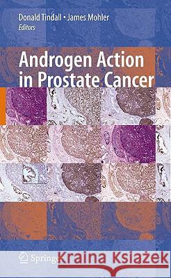 Androgen Action in Prostate Cancer Donald Tindall James Mohler 9780387691770 Springer