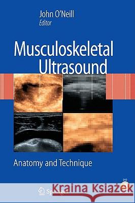 Musculoskeletal Ultrasound: Anatomy and Technique [With DVD] O'Neill, John M. D. 9780387766096 Not Avail