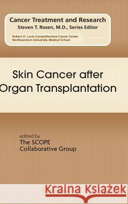 Skin Cancer After Organ Transplantation Stockfleth, Eggert 9780387785738 Springer
