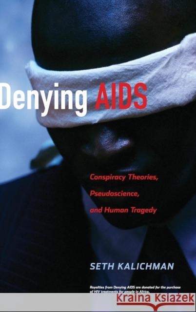 Denying AIDS: Conspiracy Theories, Pseudoscience, and Human Tragedy Nattrass, Nicoli 9780387794754