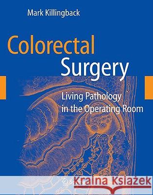 Colorectal Surgery: Living Pathology in the Operating Room Killingback, Mark 9780387880334 Springer