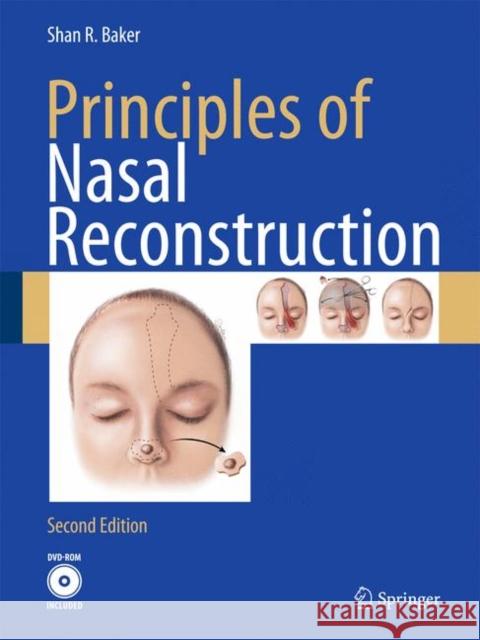 Principles of Nasal Reconstruction Shan R. Baker 9780387890272 Springer, Berlin