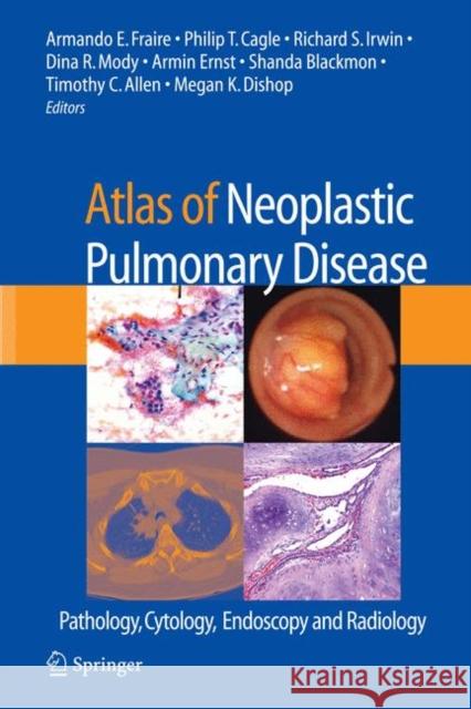 Atlas of Neoplastic Pulmonary Disease: Pathology, Cytology, Endoscopy and Radiology Fraire, Armando E. 9780387898384 Springer