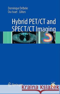 Hybrid PET/CT and SPECT/CT Imaging: A Teaching File [With DVD] Delbeke, Dominique 9780387928197