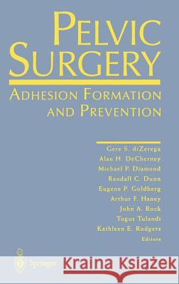 Pelvic Surgery: Adhesion Formation and Prevention Dizerega, Gere S. 9780387948713