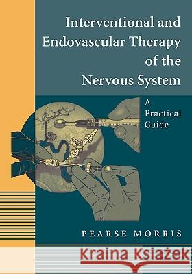 Interventional and Endovascular Therapy of the Nervous System: A Practical Guide Morris, Pearse 9780387951935 Springer