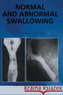 Normal and Abnormal Swallowing: Imaging in Diagnosis and Therapy Jones, Bronwyn 9780387951942 Springer