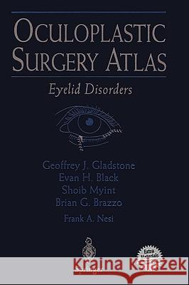 Oculoplastic Surgery Atlas: Eyelid Disorders Hengst, T. C. 9780387953168 Springer