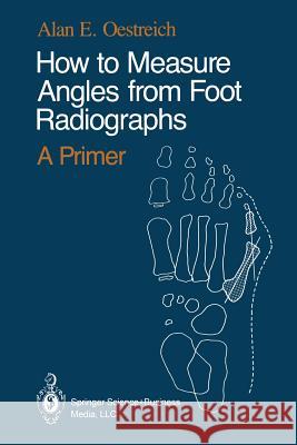 How to Measure Angles from Foot Radiographs: A Primer Oestreich, Tamar K. 9780387971070 Springer