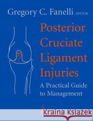 Posterior Cruciate Ligament Injuries: A Practical Guide to Management Fanelli, Gregory C. 9780387985732 Springer Us