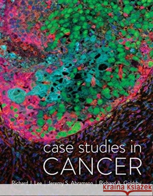 Case Studies in Cancer Jeremy S. Abramson Richard A. Goldsby Richard J. Lee 9780393679519 W. W. Norton & Company