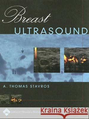 Breast Ultrasound A.Thomas Stavros 9780397516247 0