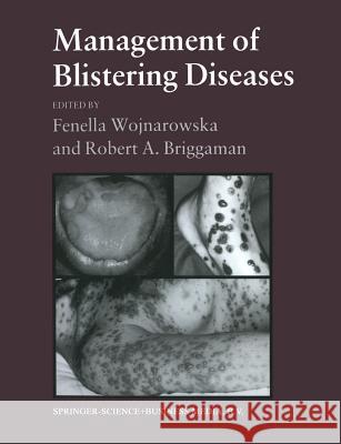 Management of Blistering Diseases Robert A. Briggaman Fenell 9780412289903 Springer