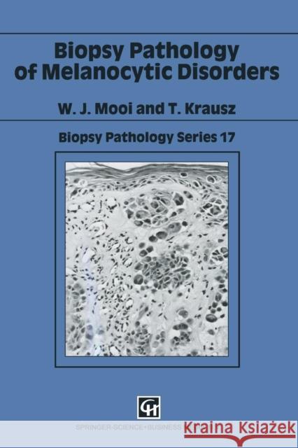 Biopsy Pathology of Melanocytic Disorders W. J. Mooi T. Krausz Walter Mooi 9780412323508 CRC Press