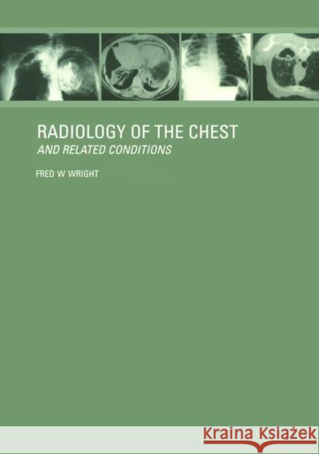 Radiology of the Chest and Related Conditions: Together with an Extensive Illustrative Collection of Radiographs, Conventional and Computed Tomograms, Wright, F. W. 9780415281416 CRC