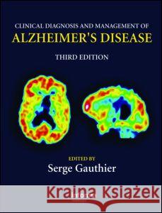 Clinical Diagnosis and Management of Alzheimer's Disease Serge Gauthier Gauthier Gauthier Serge Gauthier 9780415372992 Informa Healthcare