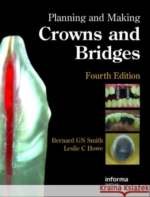 Planning and Making Crowns and Bridges   9780415398503 0