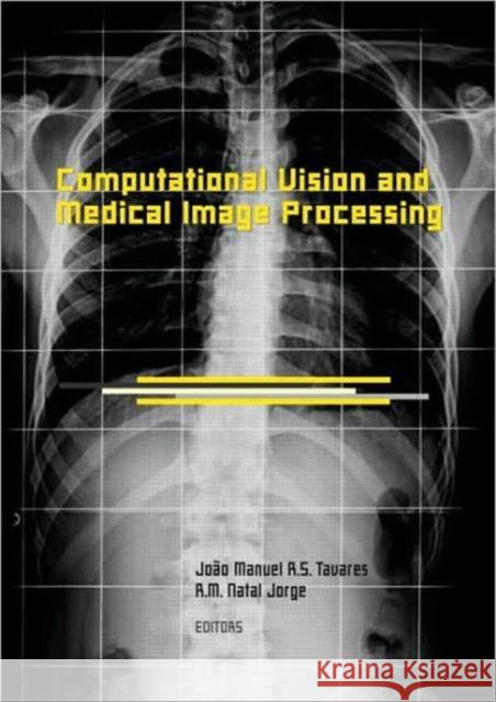 Computational Vision and Medical Image Processing: Vipimage 2007 Tavares, João Manuel R. S. 9780415457774