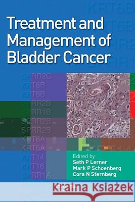 Treatment and Management of Bladder Cancer [With CDROM] Lerner, Seth P. 9780415462174 Informa Healthcare