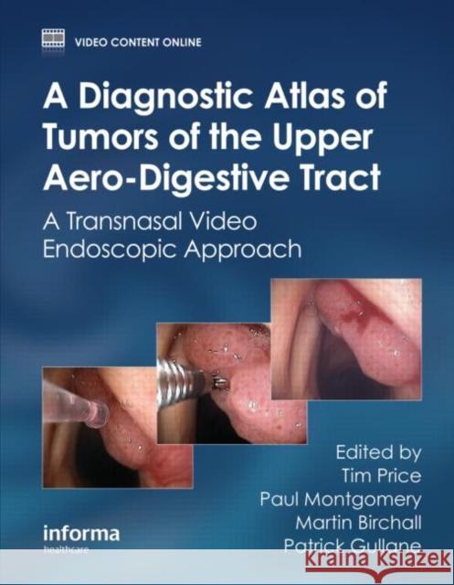 A Diagnostic Atlas of Tumors of the Upper Aero-Digestive Tract: A Transnasal Video Endoscopic Approach Price, Tim 9780415466301 Informa Healthcare