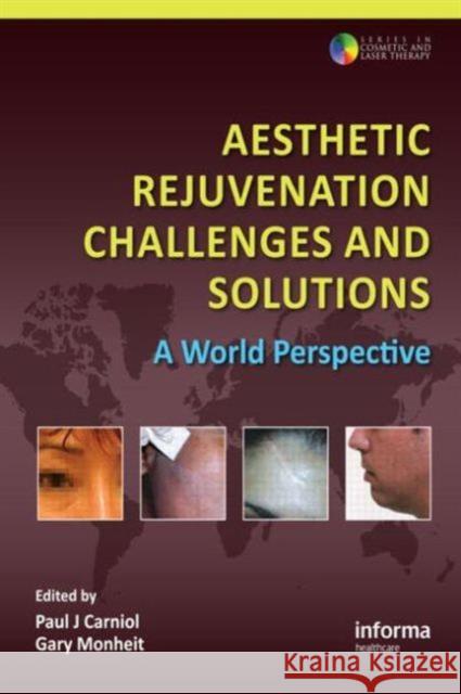 Aesthetic Rejuvenation Challenges and Solutions: A World Perspective Carniol, Paul J. 9780415475600 Informa Healthcare