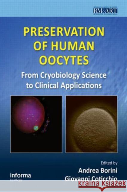 Preservation of Human Oocytes: From Cryobiology Science to Clinical Applications Borini, Andrea 9780415476799 Informa Healthcare