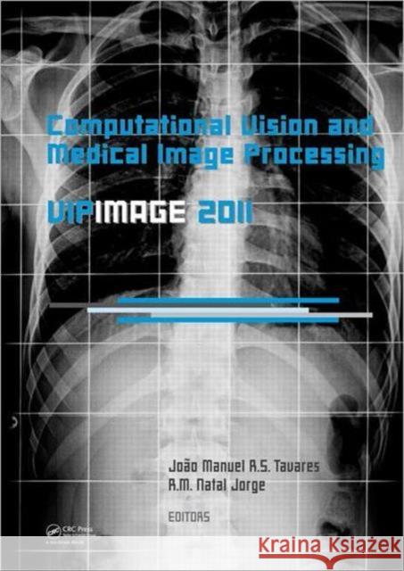 Computational Vision and Medical Image Processing: Vipimage 2011 Tavares, João Manuel R. S. 9780415683951 CRC Press