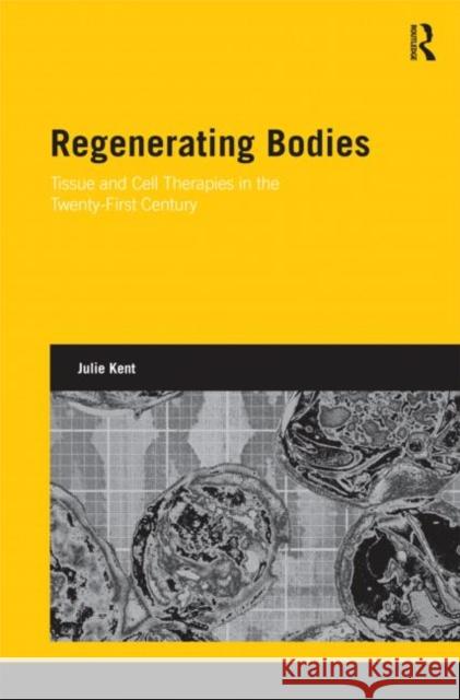 Regenerating Bodies: Tissue and Cell Therapies in the Twenty-First Century Kent, Julie 9780415688819