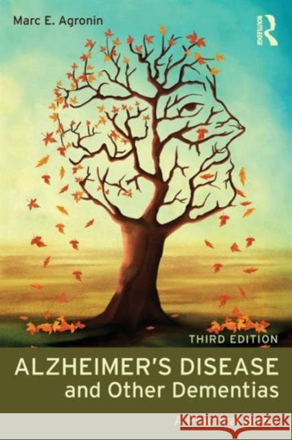 Alzheimer's Disease and Other Dementias: A Practical Guide Agronin, Marc E. 9780415857000