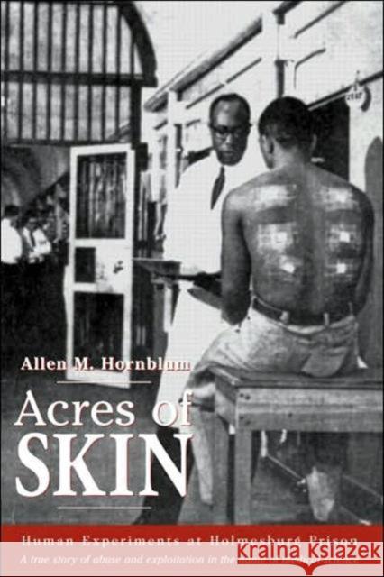 Acres of Skin: Human Experiments at Holmesburg Prison Hornblum, Allen M. 9780415919906 Routledge