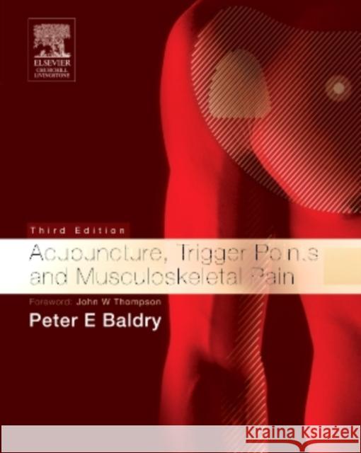Acupuncture, Trigger Points and Musculoskeletal Pain Peter Baldry 9780443066443