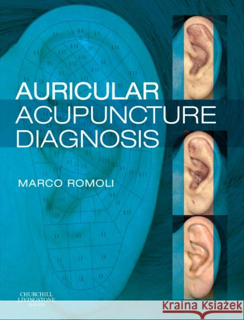 Auricular Acupuncture Diagnosis Marco Romoli 9780443068669 Elsevier Health Sciences