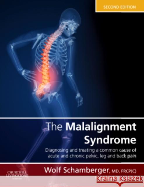 The Malalignment Syndrome: Diagnosis and Treatment of Common Pelvic and Back Pain Schamberger, Wolf 9780443069291 Elsevier Health Sciences