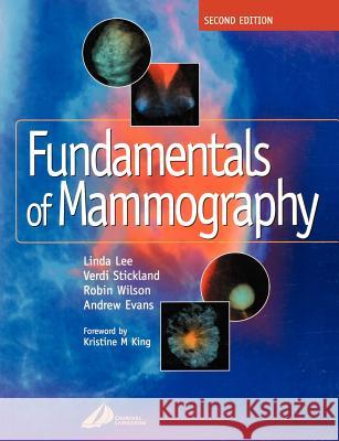 Fundamentals of Mammography Linda Lee Verdi Stickland A. Robin M. Wilson 9780443071140 