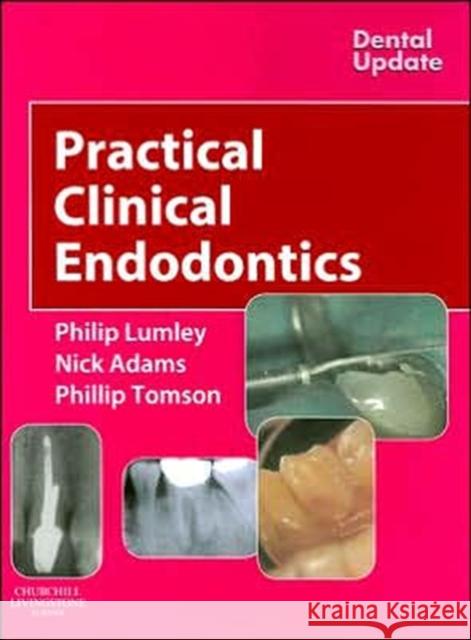 Practical Clinical Endodontics Phillip Lumley Nick Adams Phillip Tomson 9780443074820 Churchill Livingstone