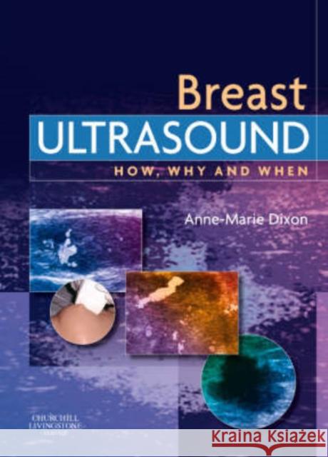 Breast Ultrasound : How, Why and When Anne-Marie Dixon 9780443100765