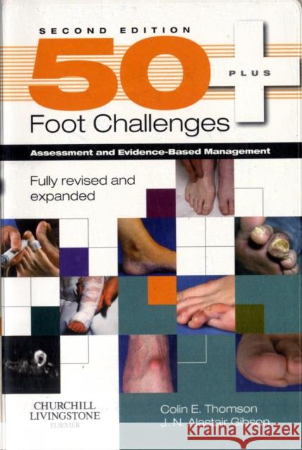 50+ Foot Challenges : Assessment and Evidence-Based Management Colin Thomson J. N. Alastair Gibson 9780443104022 ELSEVIER HEALTH SCIENCES