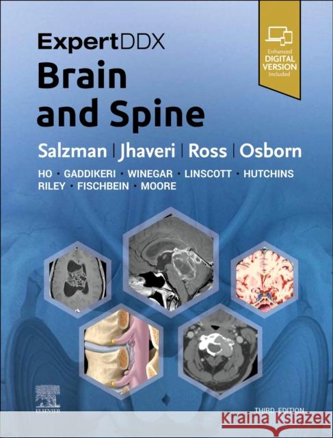 ExpertDDx: Brain and Spine Jeffrey S. (Consultant, Neuroradiology Division, Department of Radiology, Mayo Clinic Arizona, Professor of Radiology, M 9780443106941 Elsevier