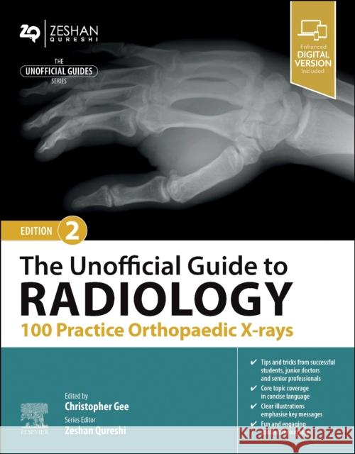 The Unofficial Guide to Radiology: 100 Practice Orthopaedic X-rays  9780443109195 Elsevier