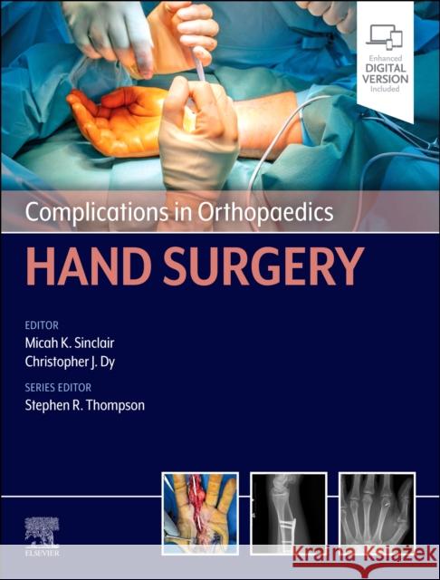 Complications in Orthopaedics: Hand Surgery Micah K. Sinclair Christopher Dy Stephen R. Thompson 9780443111297