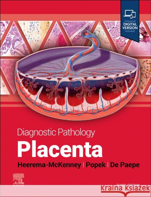 Diagnostic Pathology: Placenta Amy Heerema-McKenney Edwina J. Popek Monique E. d 9780443116544 Elsevier